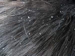 Doggy dandruff needs to be treated with the proper shampoo.