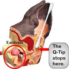 Anatomy of a dogs ear showing that a Q-tip will not reach the ear drum.